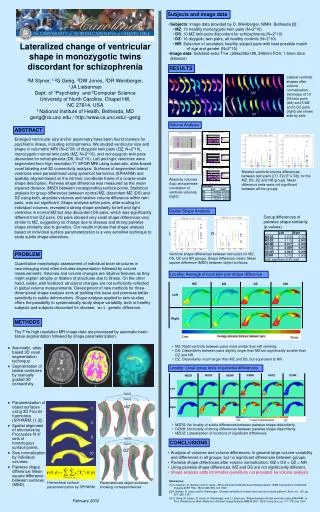 Lateralized change of ventricular shape in monozygotic twins discordant for schizophrenia