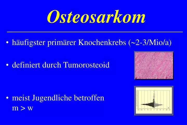 osteosarkom