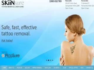 SKiinSure Tattoo Removal & Skin Clinic Newcastle