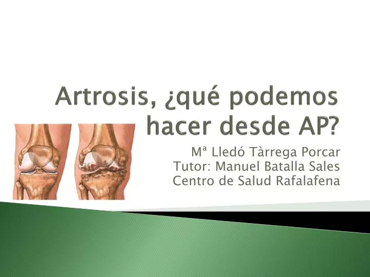 artrosis qu podemos hacer desde ap