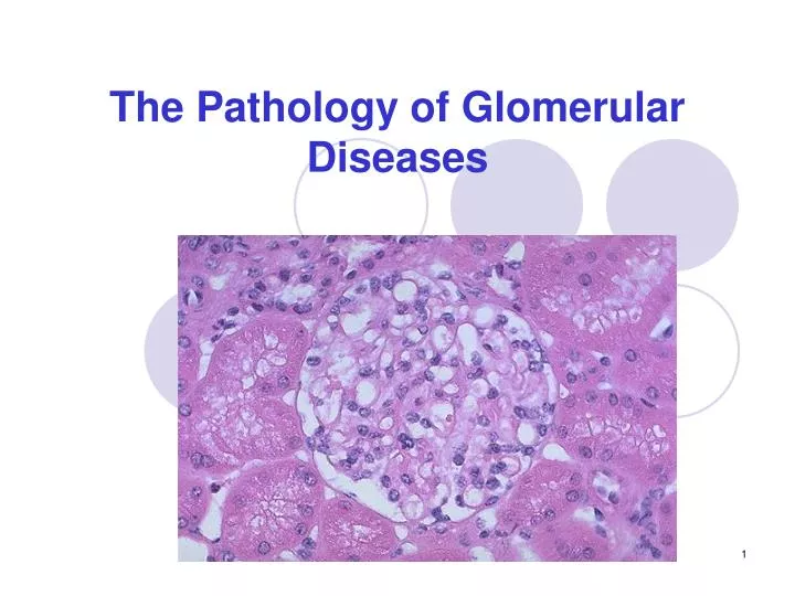 the pathology of glomerular diseases