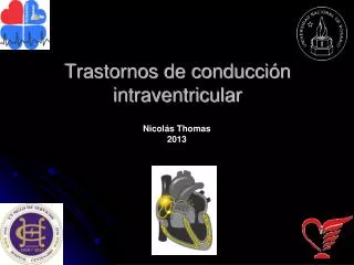trastornos de conducci n intraventricular