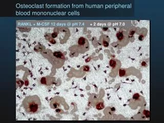 Osteoclast formation from human peripheral blood mononuclear cells