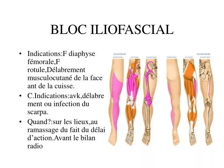 bloc iliofascial