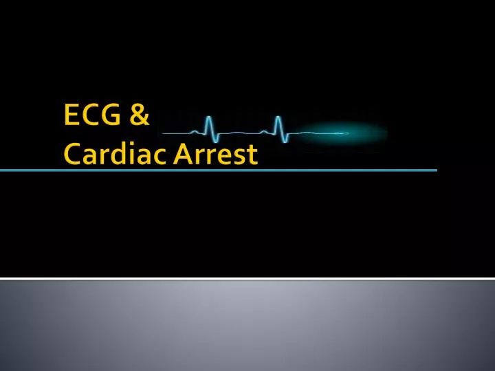 ecg cardiac arrest