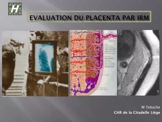 evaluation du placenta par irm