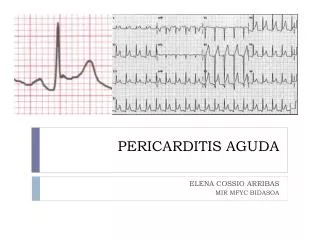 pericarditis aguda