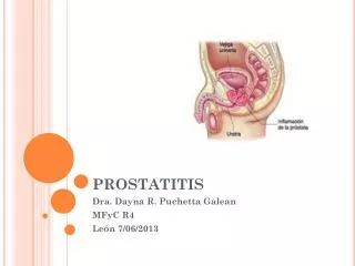 prostatitis