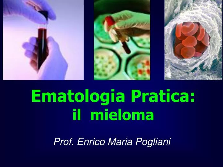 ematologia pratica il mieloma