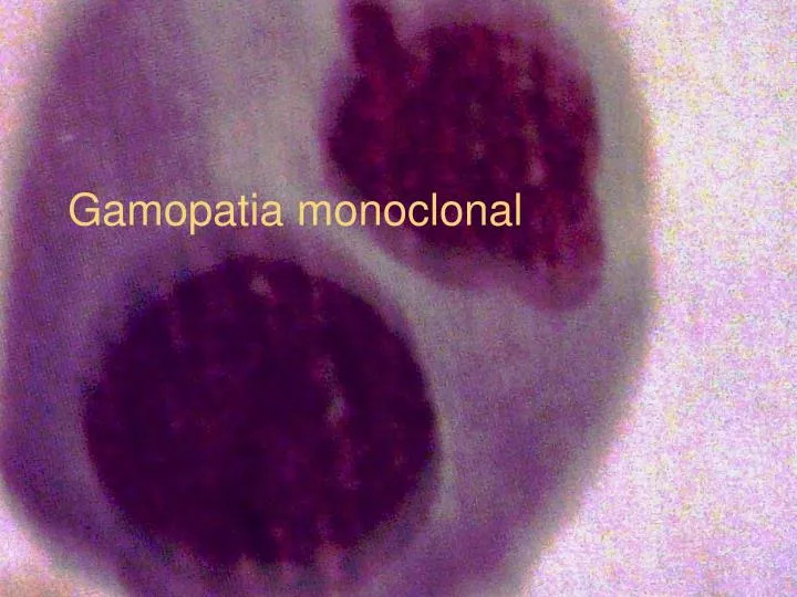 gamopatia monoclonal