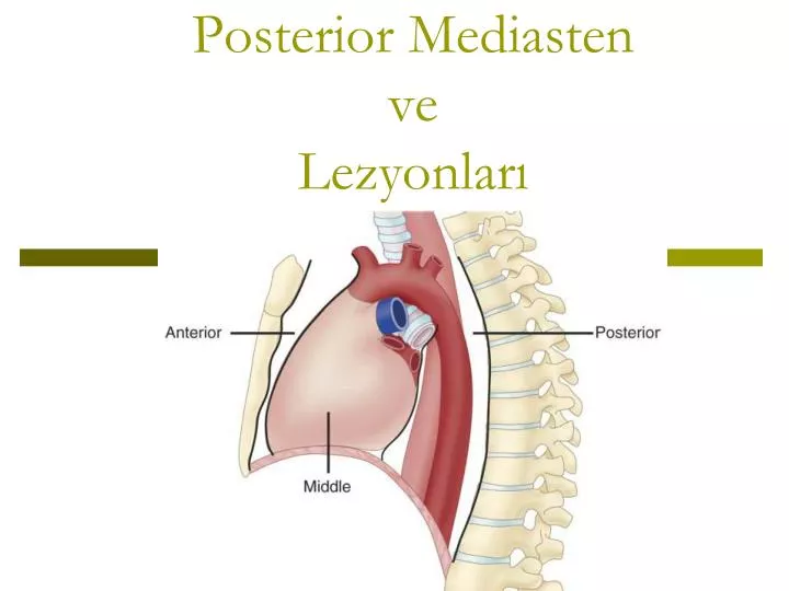 posterior mediasten ve lezyonlar