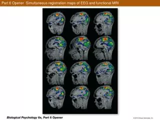 Part 6 Opener Simultaneous registration maps of EEG and functional MRI