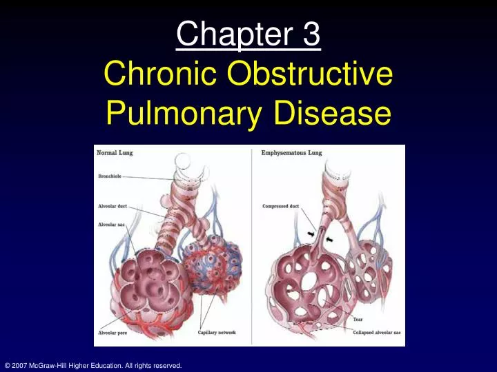chapter 3 chronic obstructive pulmonary disease