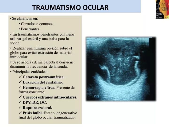 traumatismo ocular