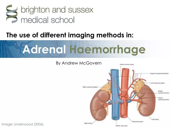 adrenal haemorrhage