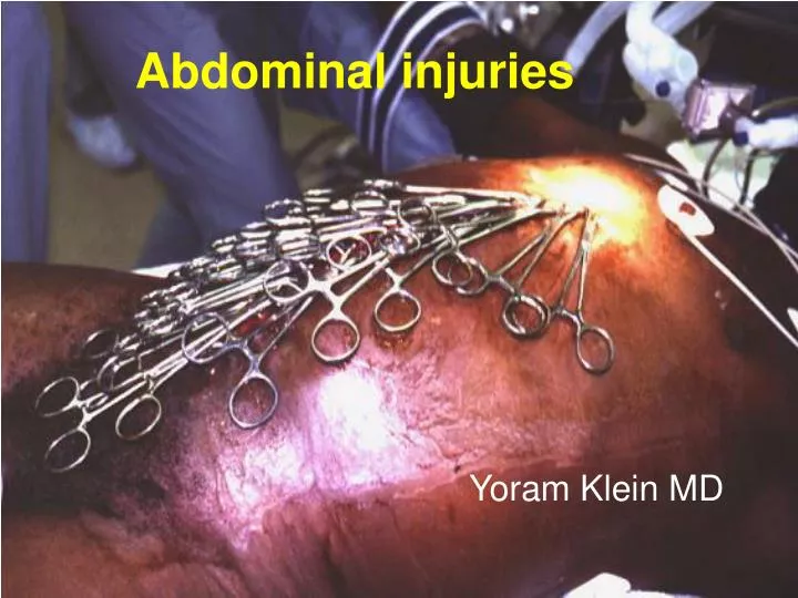 abdominal injuries