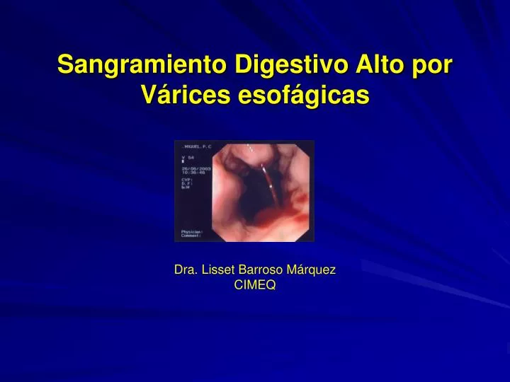 sangramiento digestivo alto por v rices esof gicas