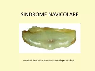 sindrome navicolare