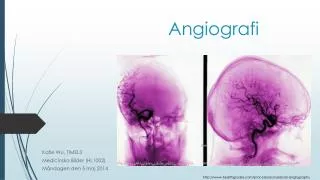 angiografi