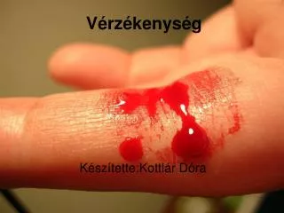 v rz kenys g