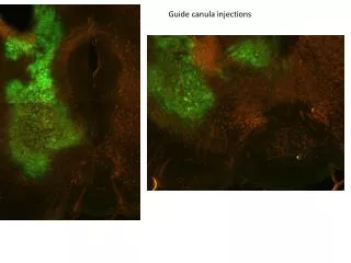 Guide canula injections