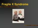 Fragile X Syndrome - slide 1