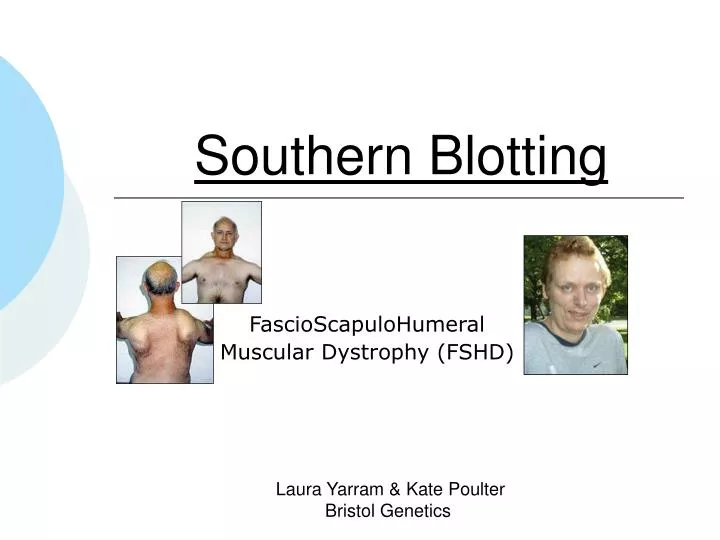 southern blotting