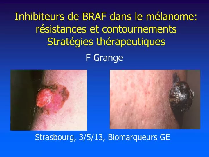 inhibiteurs de braf dans le m lanome r sistances et contournements strat gies th rapeutiques