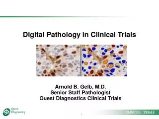 Digital Pathology in Clinical Trials