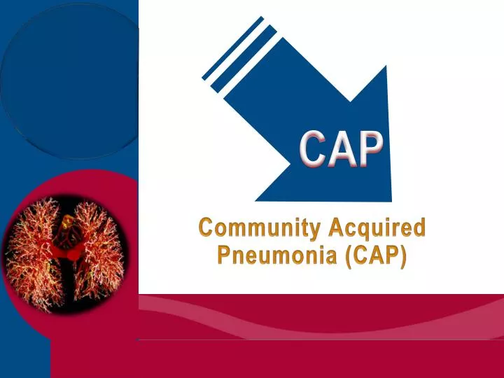 community acquired pneumonia cap