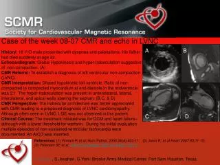 Case of the week 08-07 CMR and echo in LVNC
