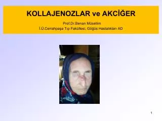 kollajenozlar ve akc er prof dr benan m sellim cerrahpa a t p fak ltesi g s hastal klar ad