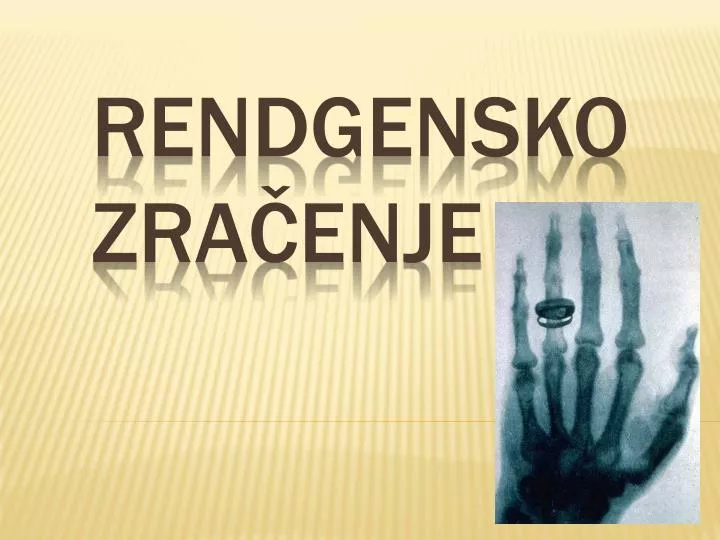 rendgensko zra enje