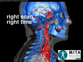 right scan right time