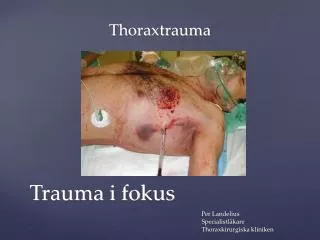 Thoraxtrauma 						Per Landelius 						Specialistläkare 						Thoraxkirurgiska kliniken