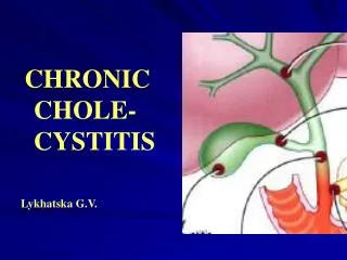 CHRONIC CHOLE-CYSTITIS Lykhatska G.V.