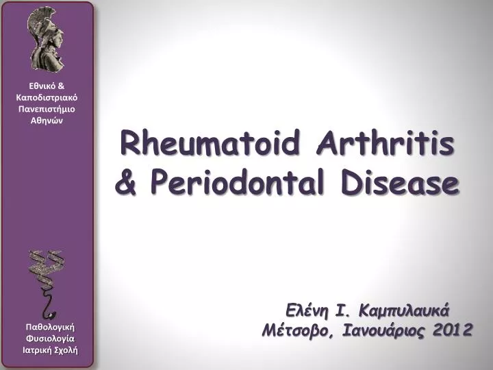 rheumatoid arthritis periodontal disease