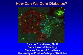 How Can We Cure Diabetes?