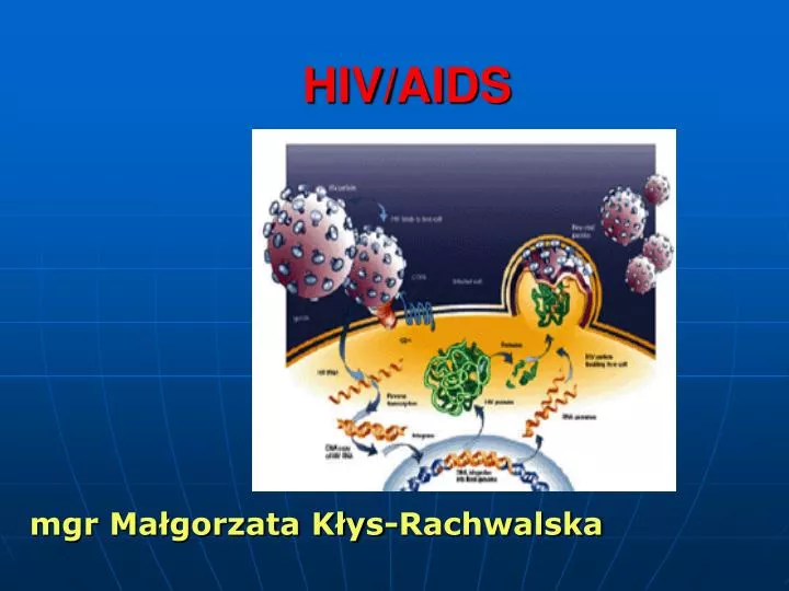 hiv aids