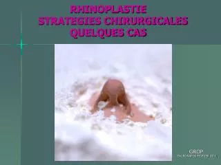 RHINOPLASTIE STRATEGIES CHIRURGICALES QUELQUES CAS