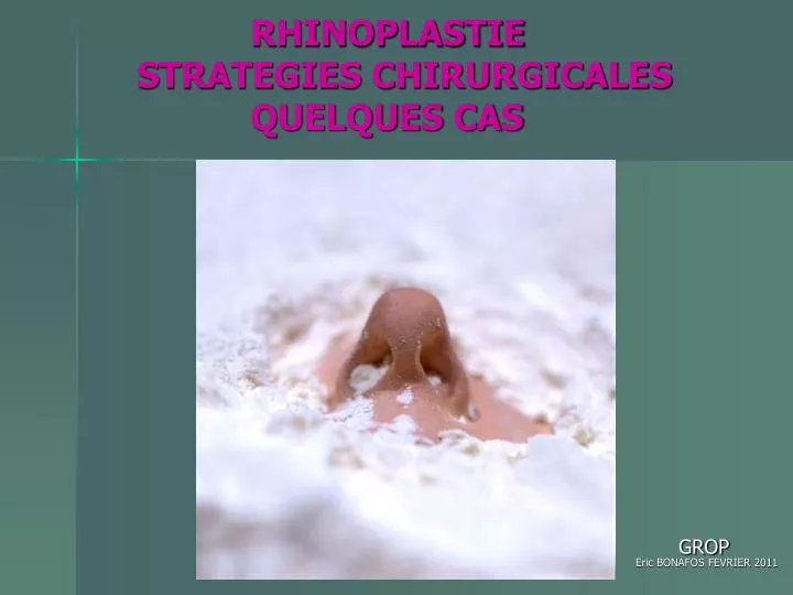 rhinoplastie strategies chirurgicales quelques cas