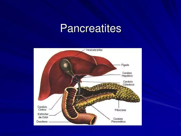 pancreatites