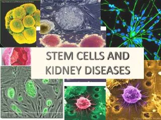 STEM CELLS AND KIDNEY DISEASES