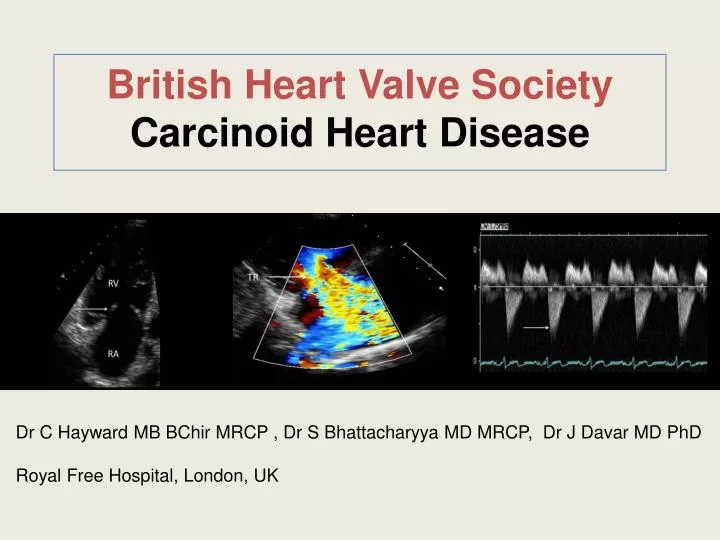 british heart valve society carcinoid heart disease