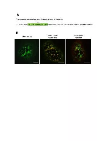 CNX11-XYLT35 + mRFP-HDEL