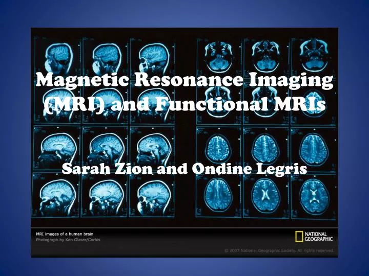 magnetic resonance imaging mri and functional mris
