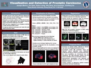 Visualization and Detection of Prostatic Carcinoma