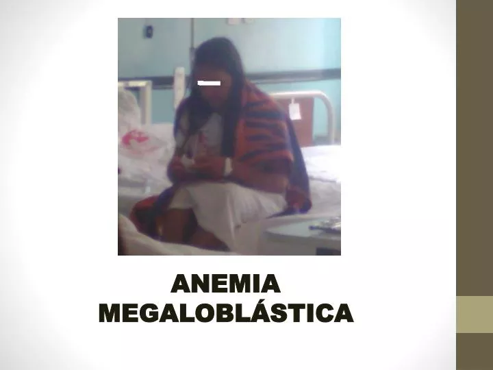 anemia megalobl stica
