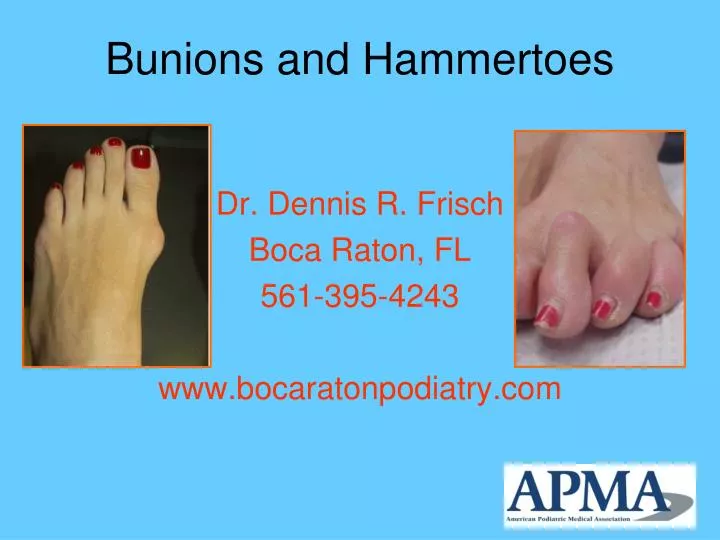 bunions and hammertoes