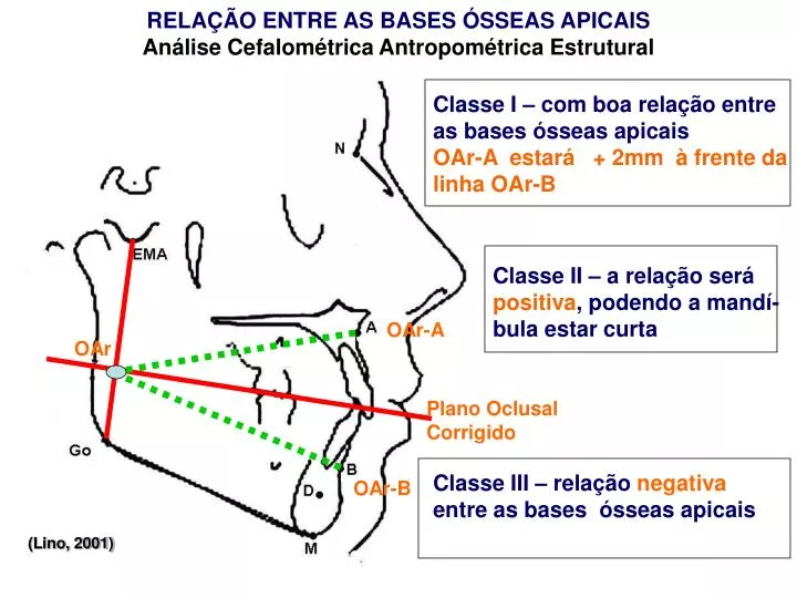 rela o entre as bases sseas apicais an lise cefalom trica antropom trica estrutural